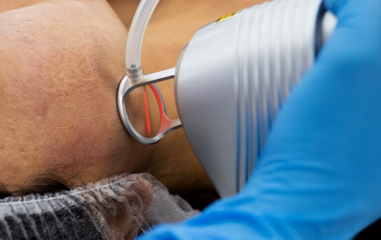 North Dallas Dermatology Associates - Co2 Laser Resurfacing